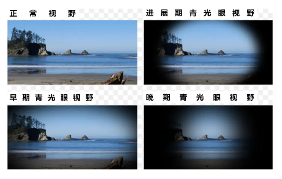 4ffeca3f9ee7a431125b193d0cdd0a2.png