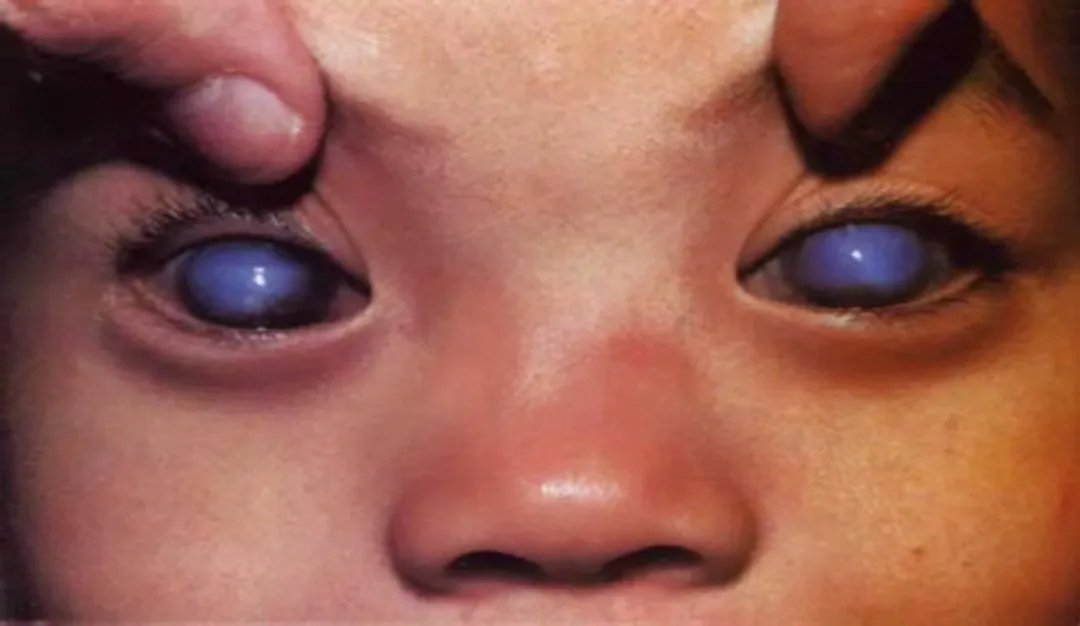 caceabb6f951a4a68d3cf3d177b432a.png