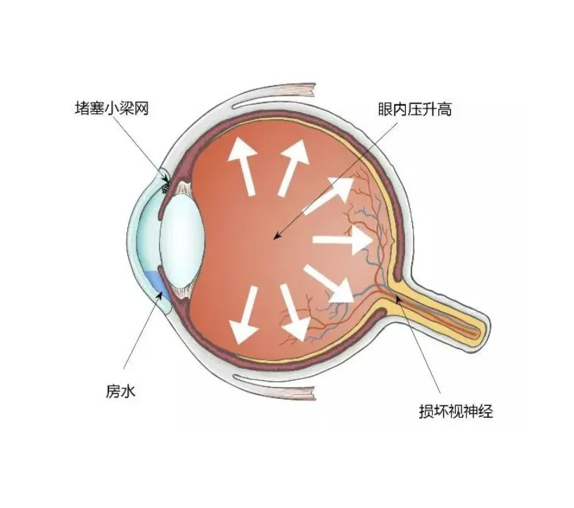 b9a9066f8f666931ae83d9ced12a27f.png