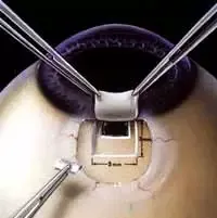 e9b253280120dae3005ecc59aca143d.png