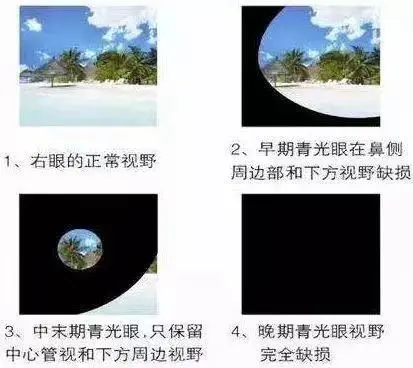fc2cc70d0bc8c0848011d411e0eb397.png