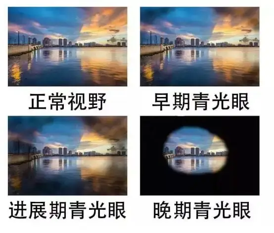 a98c9b511ec546c47351f85d92d7ee9.png