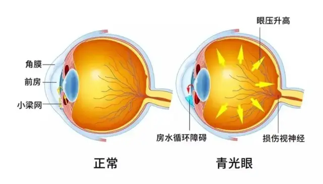 dd9eb21744183d749c97467ef3529e3.png