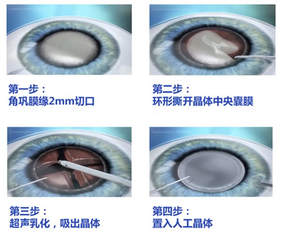 dfe0545891a67cd2e11d7d4324de13c.png