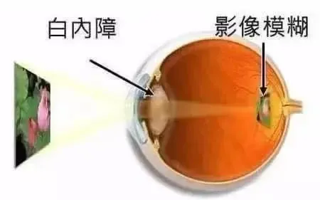 aa117b7fcc59aa0c21c0b627c82e2d1.png