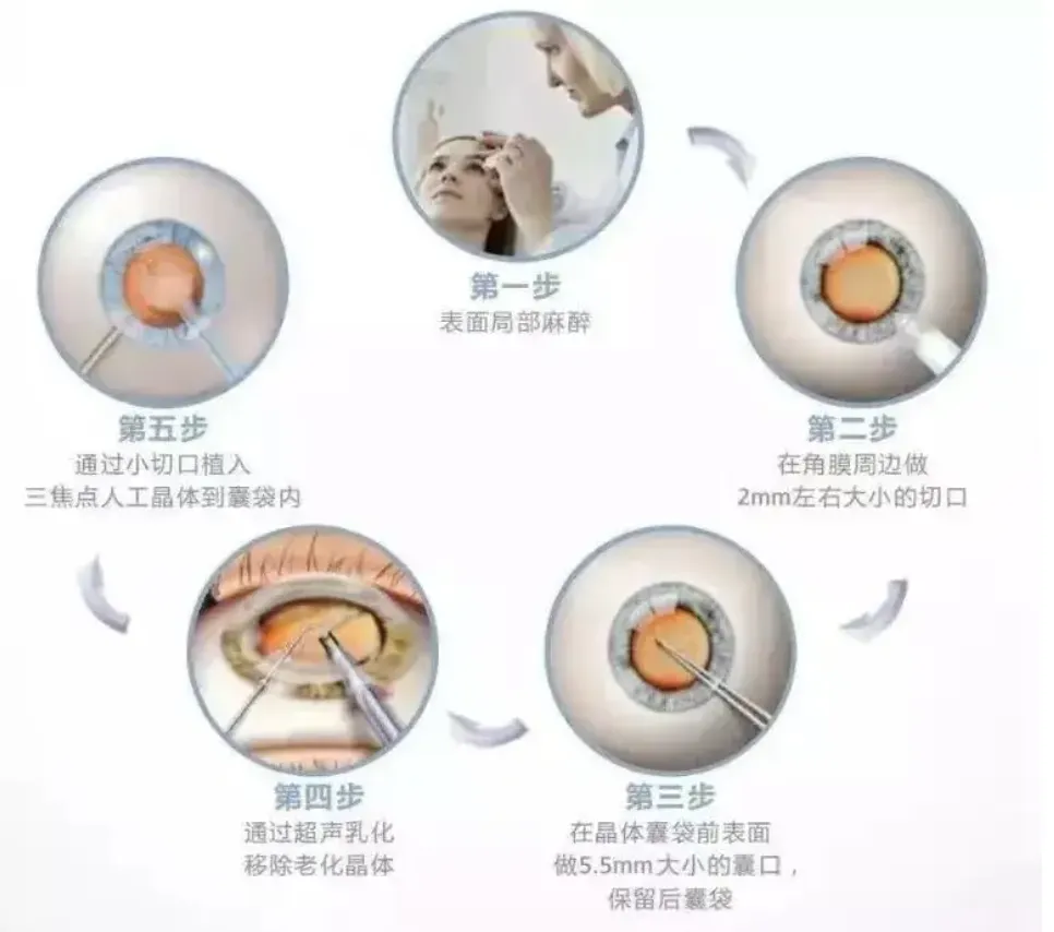 704c30314e5e73678d53e75a1b73036.png