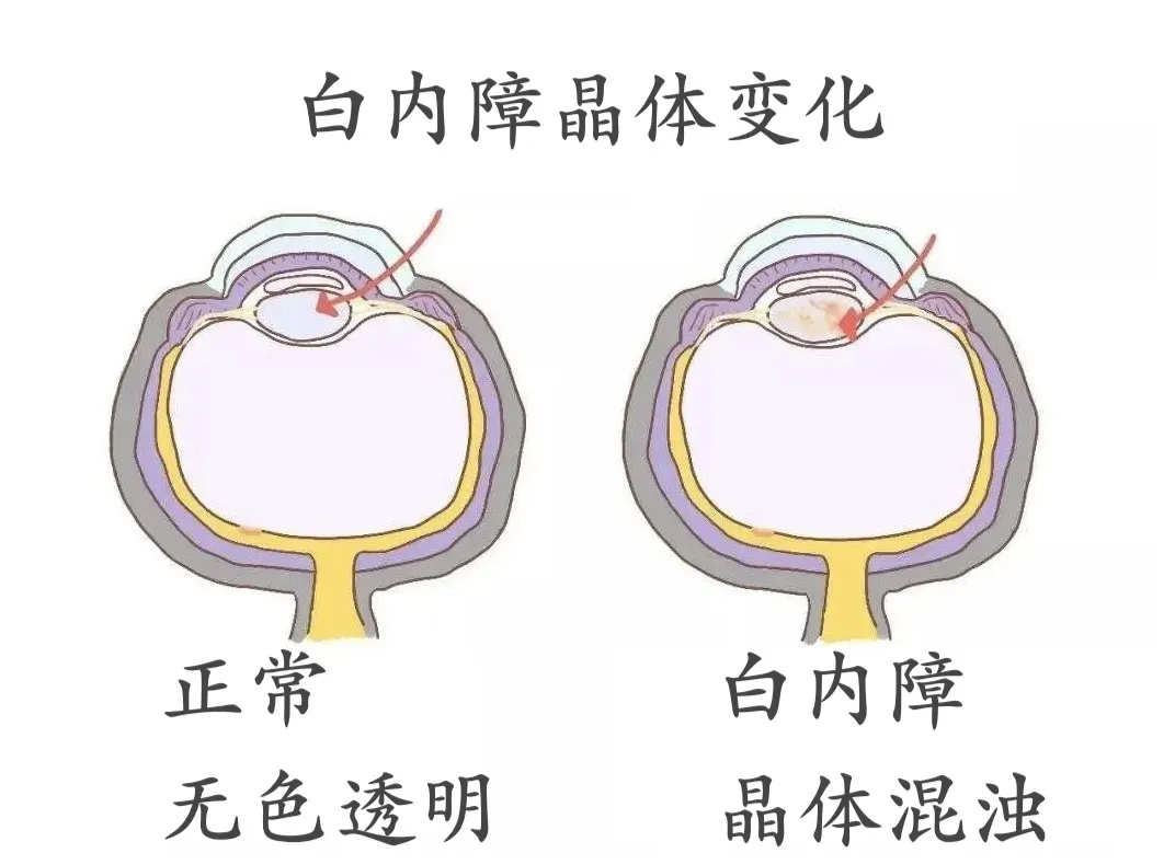 b807a05c465bd1f16fc97f9eb7d9935.png
