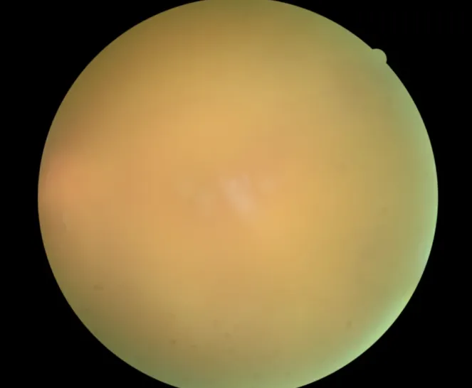 0e42b491c6c8e06d58b3418a610acd4.png