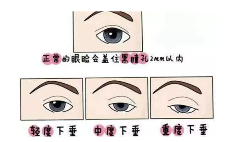 fbb4e7b1b26821103a4fe539cf5e85d.png