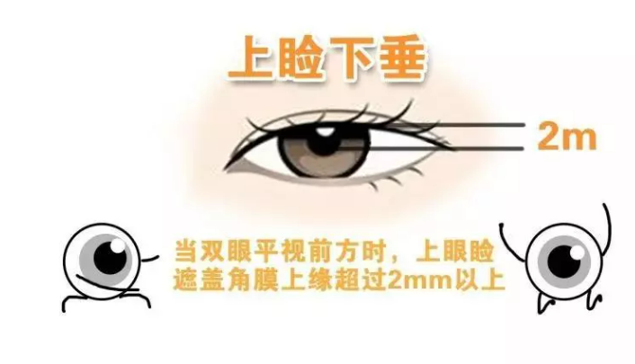 4d38205e048f4b9ac6212c29e4fcf97.png