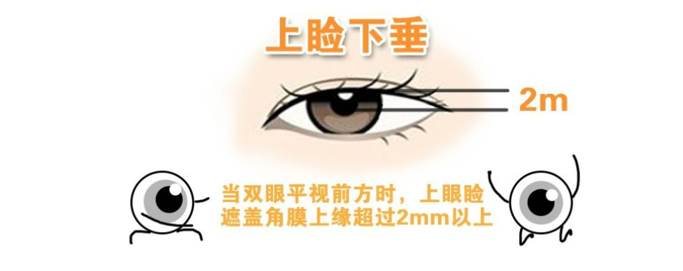 5dfda5b4e094bcf97aa6bc39b593d71.png