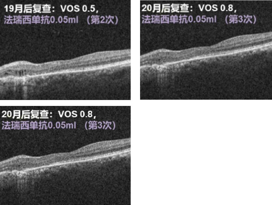 f88a267acbb18a06e932ef47b164ea17.png